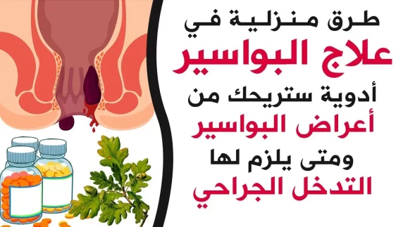علاج-البواسير-في-المنزل